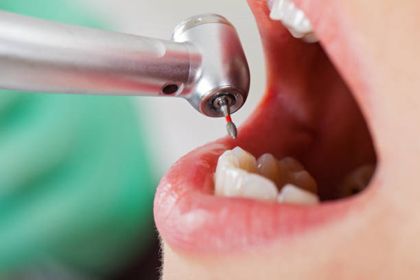 Best Emergency Dental Care for Broken or Chipped Teeth in Moodys, OK